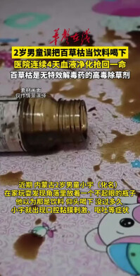 2岁男童误把百草枯当饮料喝下 ，医院连续4天血液净化抢回一命