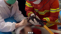 危险！5岁女孩被弓箭射中眉心