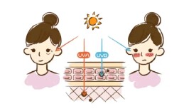 紫外线下的“隐形战役”开启，你做好防晒准备了吗？