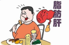 脂肪肝是否需要治疗 肝病科医生为您一次说清