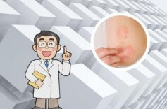 “桑拿天”警惕夏季皮肤病！医生：做好防晒、小心虫咬皮炎