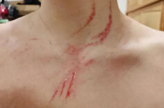 胸口全是血痕！中国女将晒照霸气回怼外国运动员！