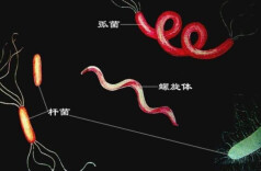 雨后赤足下田，老人感染钩体病