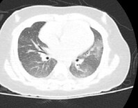 3月龄宝宝在家溺水！专家：“倒挂”不可取，反而耽误黄金急救时间！