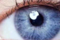 晕！最近我真的“眼冒金星”！