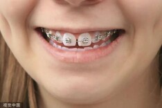 男子牙痛剧烈看急诊，诊断竟是心脏病