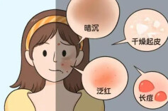 光子嫩肤后，会不会让皮肤变得敏感？皮肤科专家教你关键护理步骤