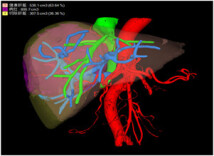增强CT“强”在哪，为什么这么“麻烦”?