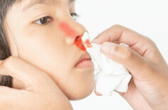 科普一下｜流鼻血时要仰头止血？