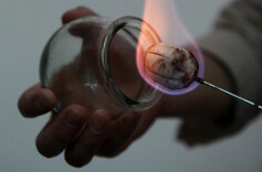 一变天就浑身不舒服？你可能需要“抽”个“风”！