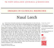 湖南中医药大学第一附属医院医生在国际顶刊《新英格兰医学杂志》发表科研文章