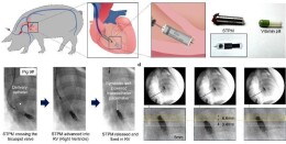 我国科学家研制出“胶囊版”自供电微型心脏起搏器