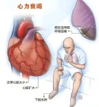 八旬重症患者救治成功！湘潭市中医医院中西医结合诊疗显功力