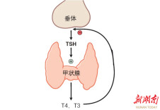 左甲状腺素的正确服用方法