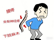 老司机20年腰痛，小针治愈多年顽疾