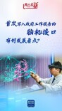 首次写入政府工作报告的脑机接口，有何发展看点？