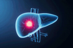 抓住养肝黄金期 建议做好这5件事