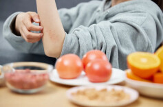 春季皮肤过敏反复难消？从用药到防护，一篇讲透