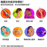 英国爆发流脑疫情 我们该如何应对？