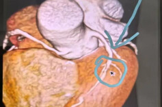 从新疆到岳阳：一场跨越千里的“心”托付