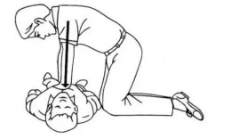 人在猝死前，小心这些蛛丝马迹！