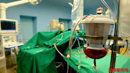 用自己的血救自己的命，男子车祸大出血实现“自体血回输”