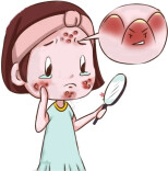 春天脸痒泛红？中医教你护好肌肤屏障