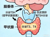 低钾血症难以纠正，可能是甲亢惹的祸