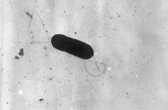 孕妇吃冰箱剩菜后去世，这个“冰箱杀手”一定要重视！