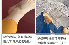 这3种网红鞋，真的很伤脚！很多人天天都在穿……