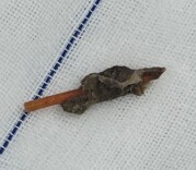 隐匿半年，辗转多家医院才找到“真凶”