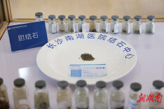 社区公益|节食减肥？她差点付出切胆代价