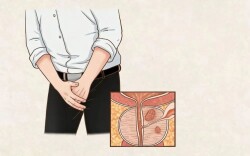 前列腺癌：你了解它吗？| 肿瘤防治早知道