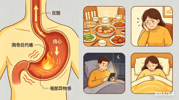调理脾胃气机，科学防治反流性食管炎