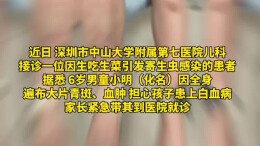 6岁男童吃生菜包烤肉后满身青斑血肿 原来是因为它