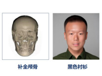 转发扩散！遗骸容貌复原，烈士可能来自东北