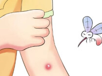 蚊子藏隐患？乙脑怎么防？这套“防护攻略”快收好 