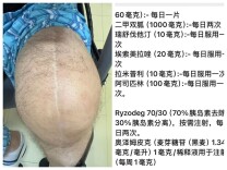 跨越山海的信任！长沙这家医院凭实力“圈粉”外籍患者