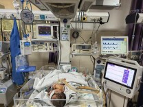 医疗服务提升年丨永州市中心医院巧用新技术成功救治危重胎粪吸入宝宝