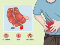 开刀还能“不留痕”？单孔腹腔镜让阑尾炎手术“隐形”