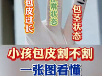 家长必看：暑期割包皮，这些知识别踩坑 