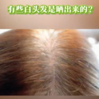 科学辟谣｜有些白头发是晒出来的？