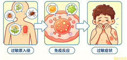 气温升高过敏频发！严重可危及生命