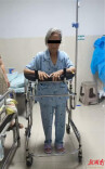 医疗服务提升年丨永州市中心医院单孔微创成功救治九旬盆腔巨瘤急症患者