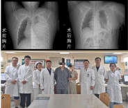 胸腔藏3.89公斤巨瘤，18岁少年在湘雅成功“拆弹”