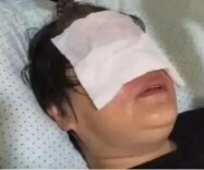  4岁男孩把它扔进热水壶，却将外婆“炸”进医院，惨遭“毁容”！消防提醒