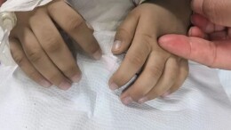 广东3岁男孩长期吃隔夜剩饭剩菜中毒，老师坚持送医救了一命