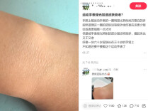 周末·提醒丨智能手环还能不能放心戴？专家建议