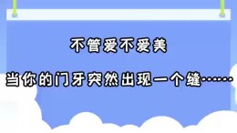不管爱不爱美，当你的门牙突然出现一个缝……