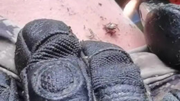 心疼！边防官兵穿密林被蚂蟥咬得鲜血直流